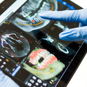 Dijital diş hekimliği: tablet üzerinde üç boyutlu tomografi (CBCT) ile implant planlaması — Ankara Çankaya